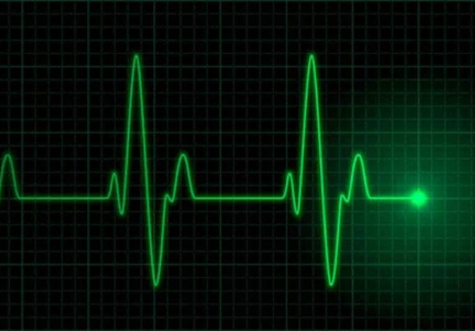 Cardiosos